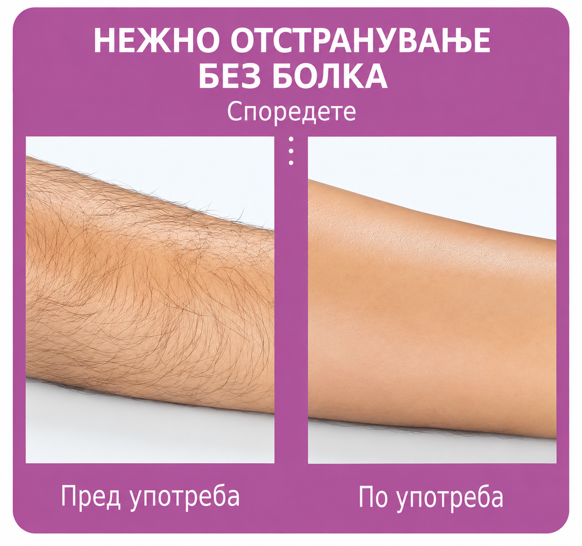 Кристален Епилатор - за Безболно Отстранување на Влакна