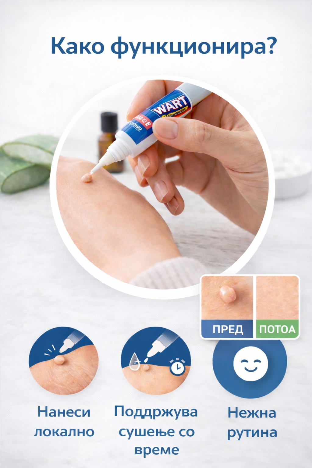 Cream Wart Remover