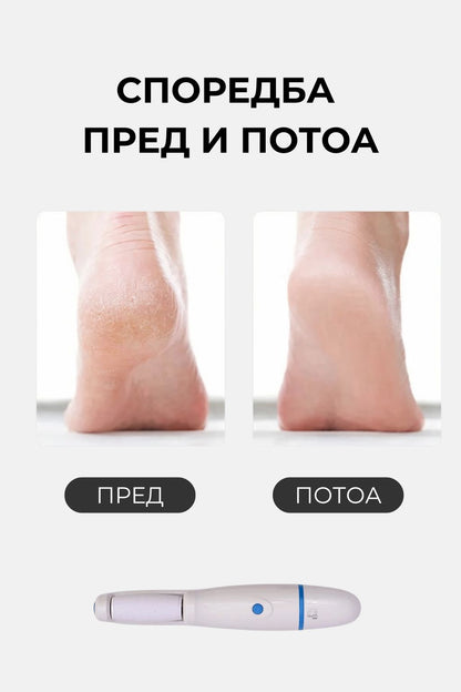 FIND BACK™ Електрична Турпија за Пети